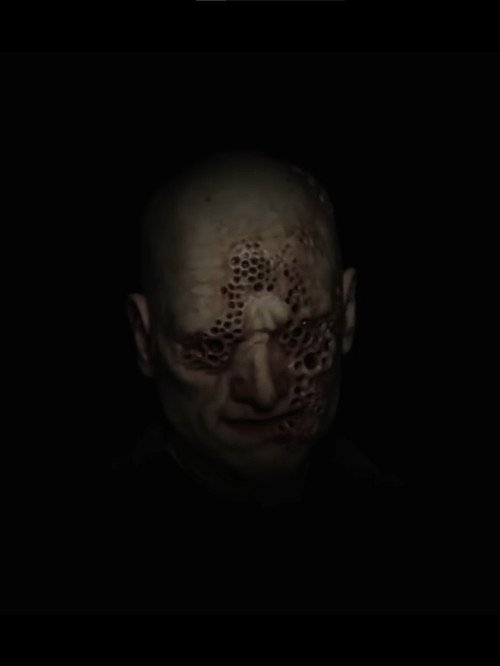 Trypophobia